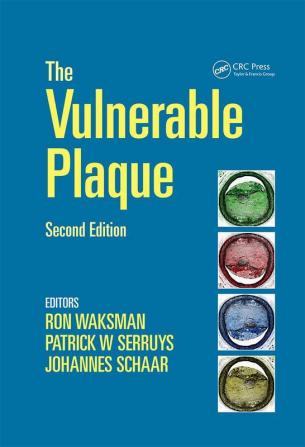 Handbook of the Vulnerable Plaque