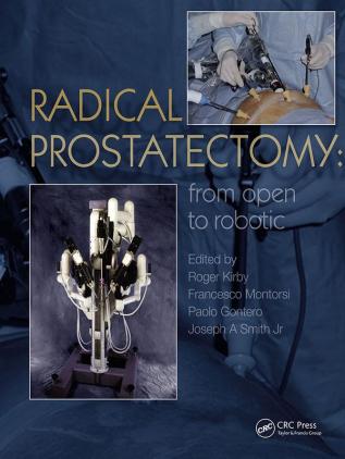 Radical Prostatectomy