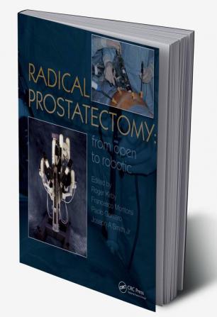 Radical Prostatectomy