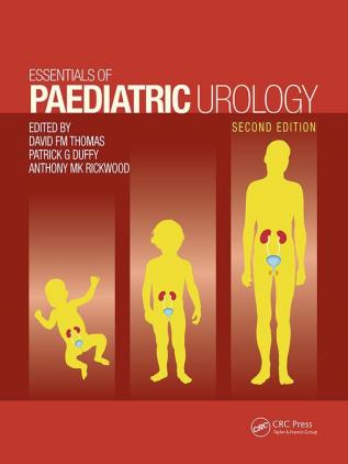 Essentials of Paediatric Urology