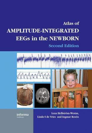 Atlas of Amplitude-Integrated EEGs in the Newborn