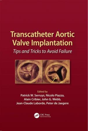 Transcatheter Aortic Valve Implantation