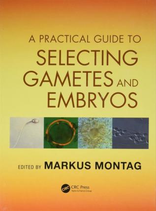 Practical Guide to Selecting Gametes and Embryos