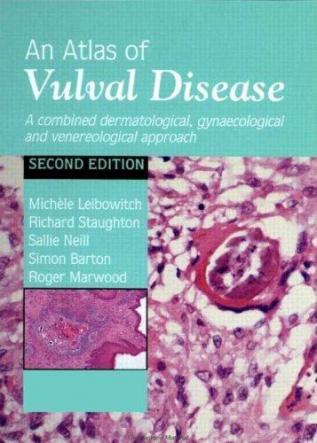 Atlas of Vulval Diseases