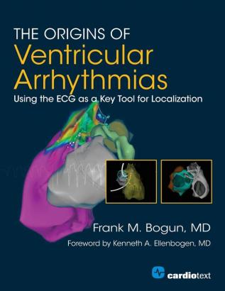 The Origins of Ventricular Arrhythmias: Using the ECG as a Key Tool for Localization