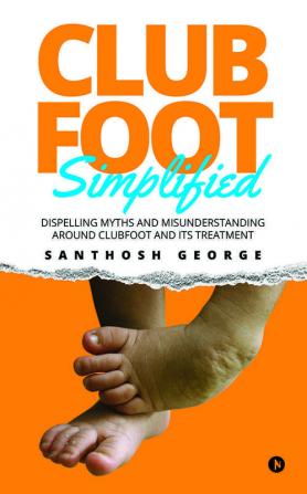 Clubfoot Simplified Dispelling Myths and Misunderstanding around Clubfoot and its treatment