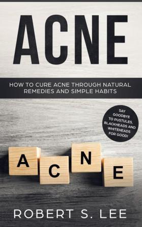 Acne: How to Cure Acne through Natural Remedies and Simple Habits. Say Goodbye to Pustules Blackheads and Whiteheads for Good!