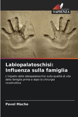 Labiopalatoschisi