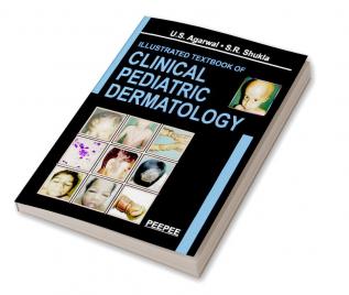 Illustrated Textbook of Clinical Pediatric Dermatology