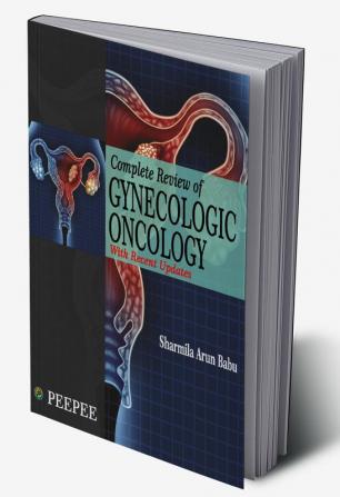 Complete Review of Gynecology Oncology