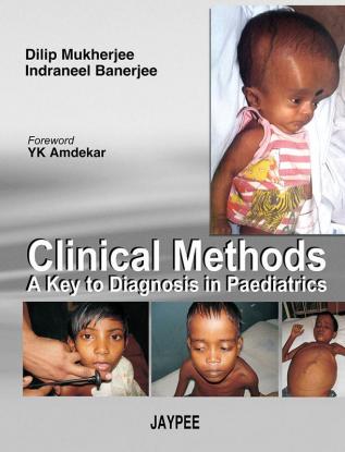 Clinical Methods A Key To Diagnosis In Paediatrics