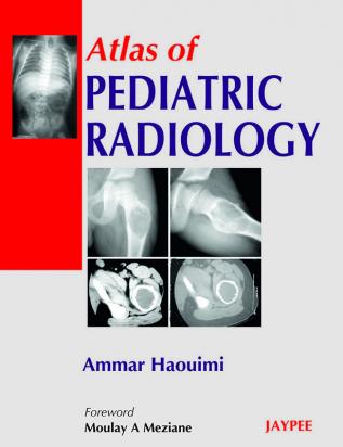 Atlas Of Pediatric Radiology