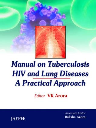 Manual On Tuberculosis Hiv And Lung Diseases A Practical Approach