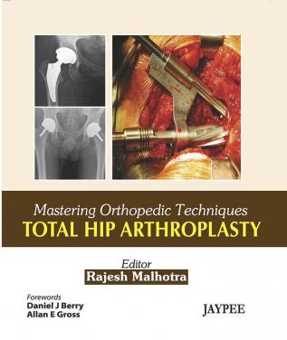 Mastering Orthopedic Techniques Total Hip Arthroplasty