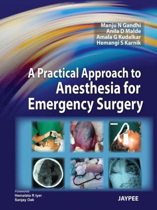 A Practical Approach to Anesthesia for Emergency Surgery