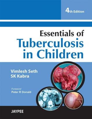 Essentials of Tuberculosis in Children