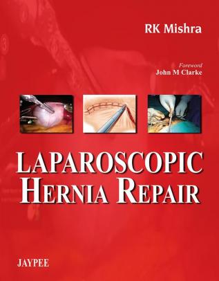 Laparoscopic Hernia Repair Includes 2 Dvd-Roms