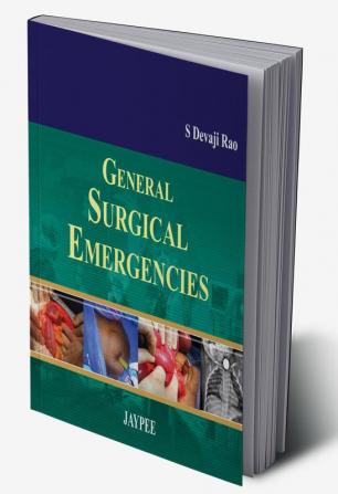 General Surgical Emergencies