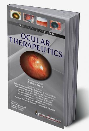 Ocular Therapeutics