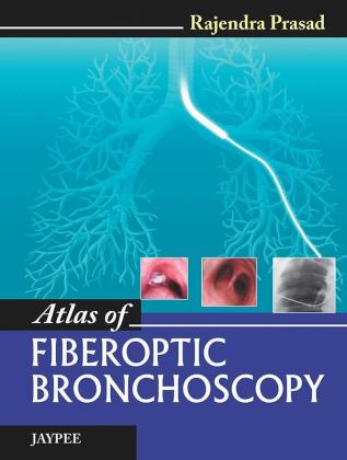 ATLAS OF FIBEROPTIC BRONCHOSCOPY