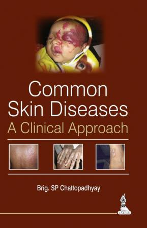 Common Skin Diseases:A Clinical Approach