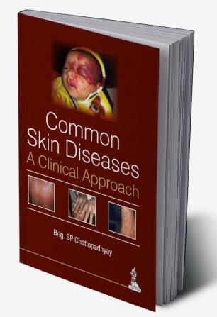 Common Skin Diseases:A Clinical Approach