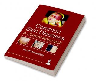 Common Skin Diseases:A Clinical Approach