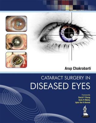 Cataract Surgery in Diseased Eyes