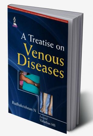 A Treatise On Venous Diseases