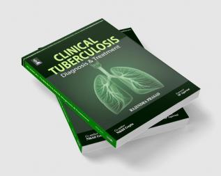 CLINICAL TUBERCULOSIS DIAGNOSIS & TREATMENT