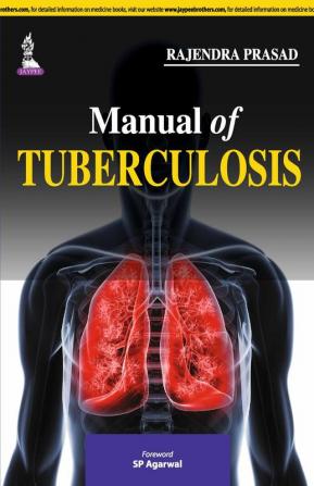 Manual of Tuberculosis