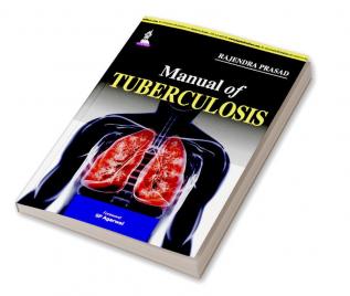 Manual of Tuberculosis