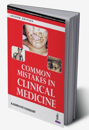 COMMON MISTAKES IN CLINICAL MEDICINE