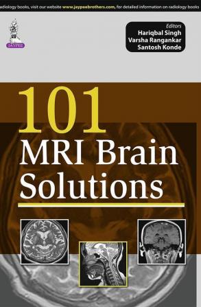 101 MRI BRAIN SOLUTIONS