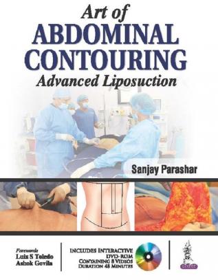 Art of Abdominal Contouring: Advanced Liposuction