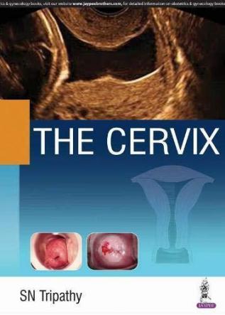 THE CERVIX