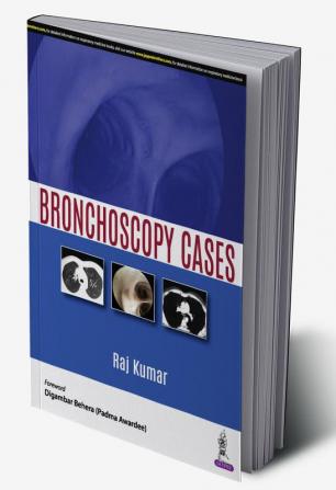 Bronchoscopy Cases