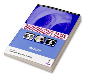 Bronchoscopy Cases