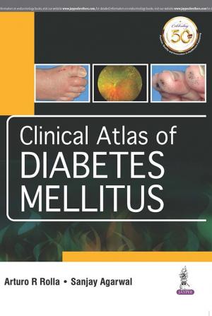 Clinical Atlas of Diabetes Mellitus