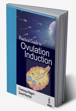 PRACTICAL GUIDE TO OVULATION INDUCTION