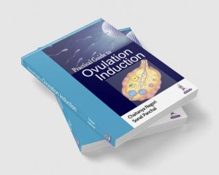 PRACTICAL GUIDE TO OVULATION INDUCTION