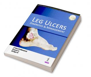 LEG ULCERS: DIAGNOSIS & MANAGEMENT 1st end