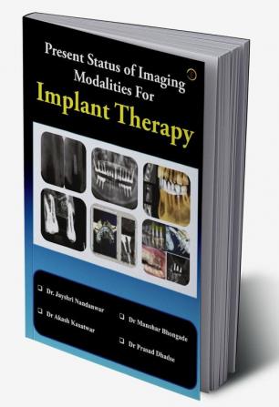 Present Status of Imaging Modalities For Implant Therapy