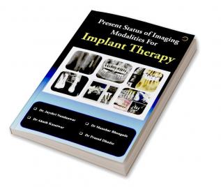 Present Status of Imaging Modalities For Implant Therapy