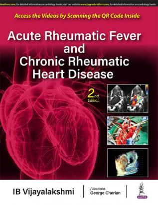 Acute Rheumatic Fever and Chronic Rheumatic Heart Disease