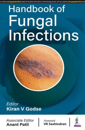 Handbook of Fungal Infections