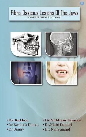 Fibro Osseus Lesion Of The Jaw