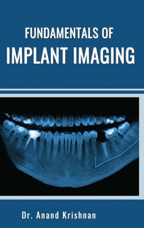 FUNDAMENTALS OF IMPLANT IMAGING