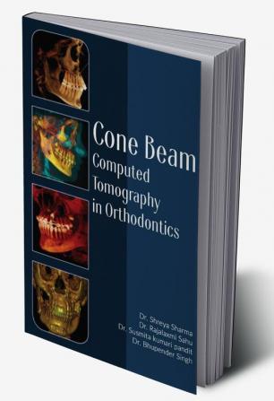 CONE BEAM COMPUTED TOMOGRAPHY IN ORTHODONTICS