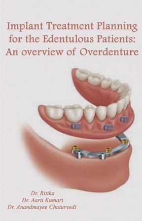 IM PLANT TREATMENT PLANNING FOR THE EDENTULOUS PATIENTS: ANOVERVIEW OF OVERDENTURE